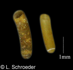 Caecum dextroversum